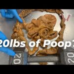 How Much Poop Is Stored in Your Colon??