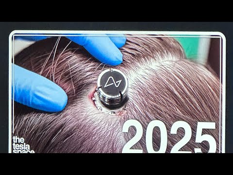 🚨MOTB News ‼️ How Neuralink will break reality in 2025 🧠 🤖 🤚 💻