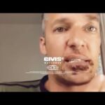 The Monkeypox is Nasty & Real [HD] @GMSWATCHMEN