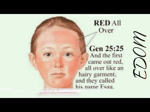 The Perfect Description Of Es🙍🏼u Edom‼️